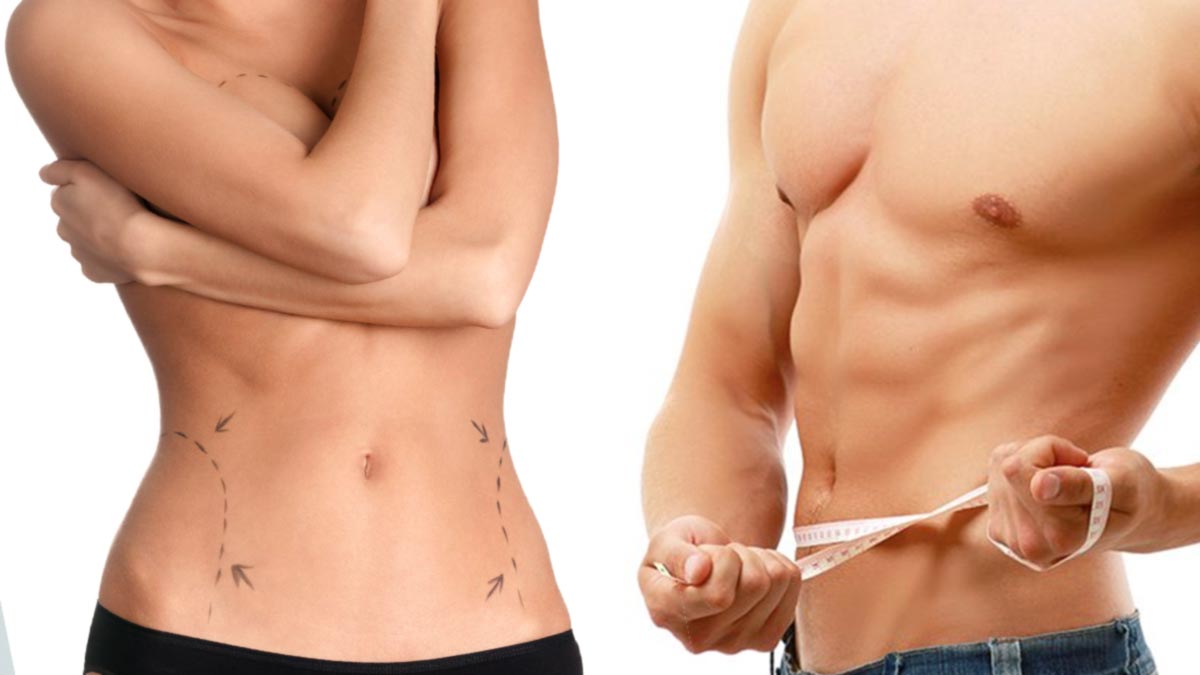 Άνδρες και λιποαναρρόφηση κοιλιάς: Πώς να αποκτήσετε six pack | 8kb.es